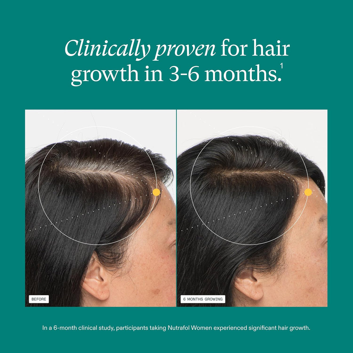 Nutrafol Women’s Balance Hair Growth Supplement