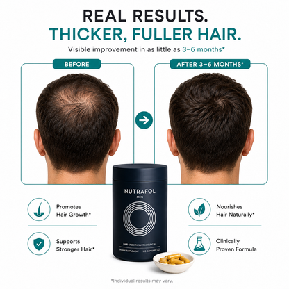Nutrafol Men Hair Growth Supplement – 120 Capsules